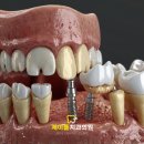 제이플치과의원 이미지