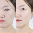 얼굴리프팅기기 홈케어 뷰티디바이스 홈쎄라 구매할 만할까?