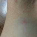 나비약국 이미지