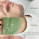 유아이뷰티 네이버블로그