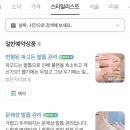 레푸스이천