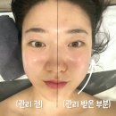 가정동 윤곽관리 잘하는 곳 &#39;루담에스테틱&#39; 솔직 후기 | 루원시티 윤곽관리 잘하는 곳 | 가정동 윤곽...