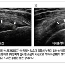 어깨통증과 오십견, 아는 만큼 보인다! 이미지