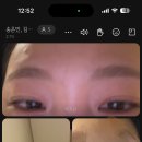 방이우리들안경 이미지