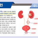 요로결석 증상 옆구리 통증 요로결석통증 수술 원인 제거 이미지