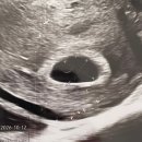 유테라산부인과의원 | [임신 5주차] 유테라산부인과 범계역 난황 확인 및 입덧약 처방, 부모님 임밍아웃 준비