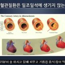 당신의 혈관이 깨끗해야 하는 이유 이미지