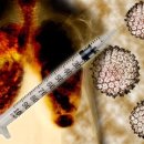 Study Links HPV to Lung Cancer 이미지