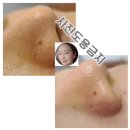 방배중앙로15길 39 | 타임필- 타임필링 (방배동올가스킨)12월2차(겨울전용타임필방법) 공구진행예정입니다~