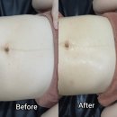 테라스 인 스킨 | 김포 에스테틱 추천 | 산후 복부관리부터 스킨케어까지 가능한 빛나는지금 김포점 후기