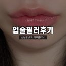 강남 입술필러 후기 숫자 피부클리닉 올립필러