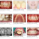유성치과기공소 | 대전치과유명한곳, 대표원장이 주말까지 매일 진료합니다!