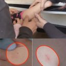 손과바늘 이미지