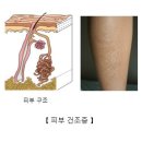 ★ ~ 피부 건조증 ?? 이미지