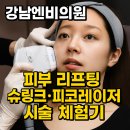 강남엔비의원, 피부 리프팅 슈링크·피코레이저 시술 체험기