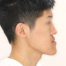 맥스구강악안면외과치과의원 | 양악 윤곽 차이, 나에게 적합한 수술은?_맥스구강악안면외과 박재봉 원장