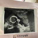 김영남한의원 | [임신5개월] 기형아검사 신경관결손 고위험군 개금미래여성병원 양수검사 후기, 비용