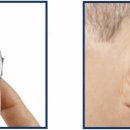 에바다보청기 이미지