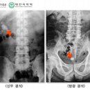 신장축산 이미지