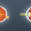 유밸안과의원 이미지