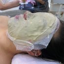 운암제일한의원 | 광주 여드름흉터 전문케어 [ 운암동 푸른아로마 ] 특수관리 받은 리얼후기