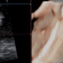 검단아라산부인과의원 네이버블로그