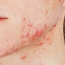 내맘에한의원 이미지