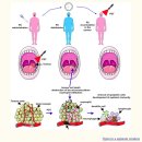 최신 항암치료법 광역학요법 PHOTODYNAMIC THERAPY OF CANCER: AN UPDATE 이미지