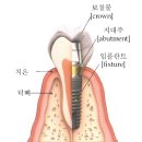 김동수치과의원 네이버블로그