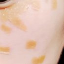 압구정톡스앤필의원 이미지