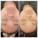 라움메디 이미지