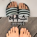 레푸스증포