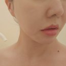 용산-167 | 용산피부관리 온플릭 에스테틱 SQL 디자인 페이스핏 관리 리얼 후기