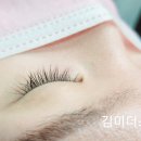 김미더스킨