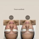 쉼,skincare | 의정부 피부관리 문제성피부 해결 어디가 좋을까 ?문제성 피부 개선 방법과 효과 총정리 ( 비움에스테틱...