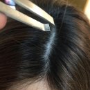 암세포가 내 몸을 덮었다는 증거 흰머리 이렇게 나면 바로 암 병원부터 뛰어가세요. 이미지