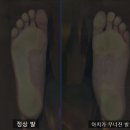 독일인솔