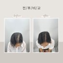픽스칼프 이미지