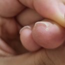 하나세인스톤2차 | [서울] 내성발톱교정 네일샵 찐후기(병원은 무서워서 네일샵 고민중인 사람)