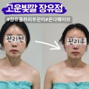 장유상가 관리사무소 | 김해 장유 피부관리 고운빛깔 온다웨이브 리프팅 리얼후기