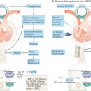 D00907 | 만성 신부전의 병태생리학(Pathophysiology of chronic renal failure)