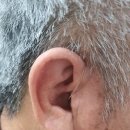 시그니아독일보청기대구북구센터 이미지