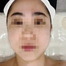 GS노은점 | 유성구피부관리 지족동피부관리실 &#34;오르네스킨타이트닝&#34;