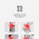 JY 메디칼 이미지