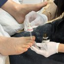푸스케어&페디솔루션 | 대구 문제성 발관리 | 무좀 스케일링 르엘라 푸스케어