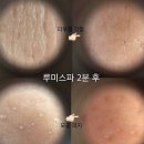 누스킨