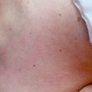 에스에이(SA)왁싱 스킨케어 | [야당 피부관리] SA왁싱&amp;스킨케어에서 편평사마귀 타파하고 온 후기