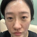 은성한의원 | 잠실 피부과 LDM 물방울리프팅으로 광채피부 후기 관리