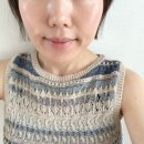 사려니의원 얼굴,목 편사제거일주일 후기