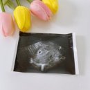 정성일산부인과의원 이미지